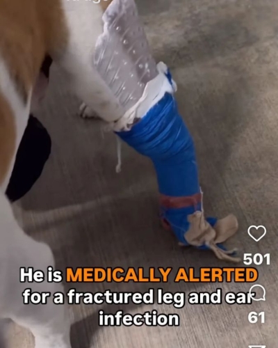 Derek’s fractured leg wrapped in blue medical bandage during treatment